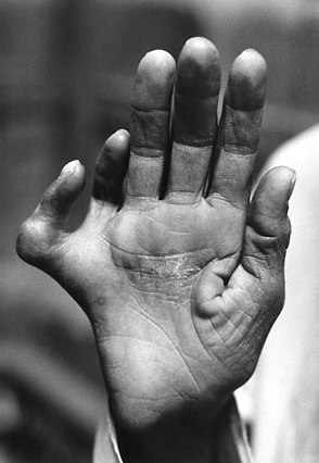 HAND